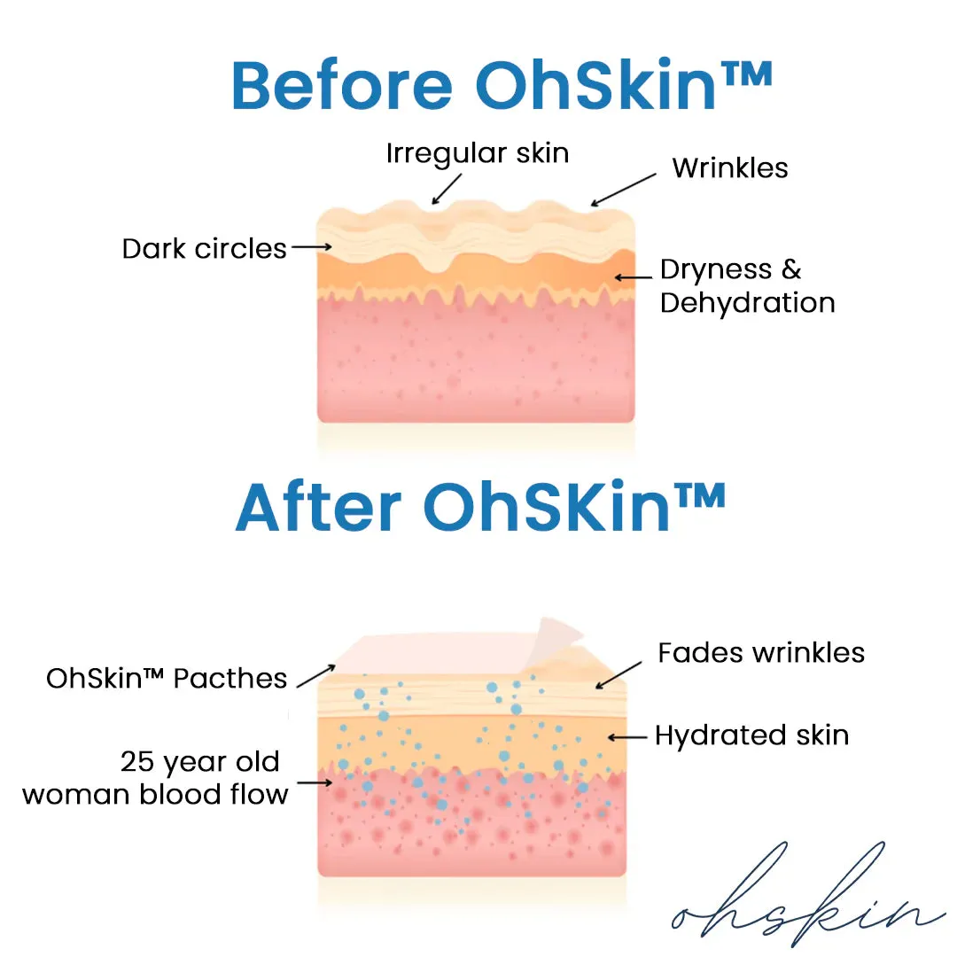 NEW OhSkin™ - Anti-wrinkles Patches, 5 Piece! Reusable up to 10 Times! Eliminates up to 98% of wrinkles! Instant visible results! #1 Wrinkle care in the UK!